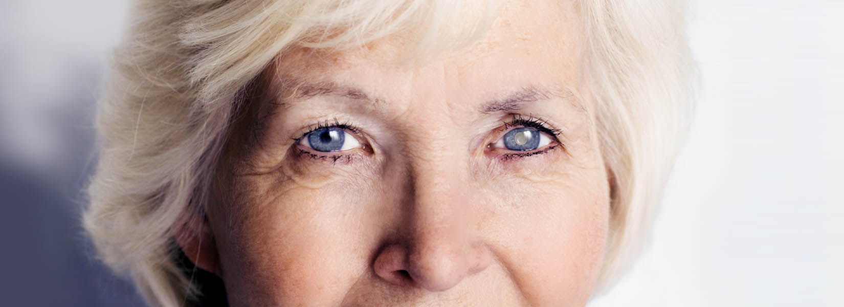 Cataract Surgery in Jefferson Hills